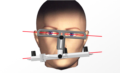 Messung der ästhetisch-okklusal-harmonischen Informationen über das Gesicht des Patienten